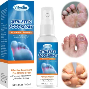 Athletes Foot Spray - Athletes Foot Treatment for Soothe Itching Skin & Prevents Athletes Foot, Naural & Gentle, 60ml