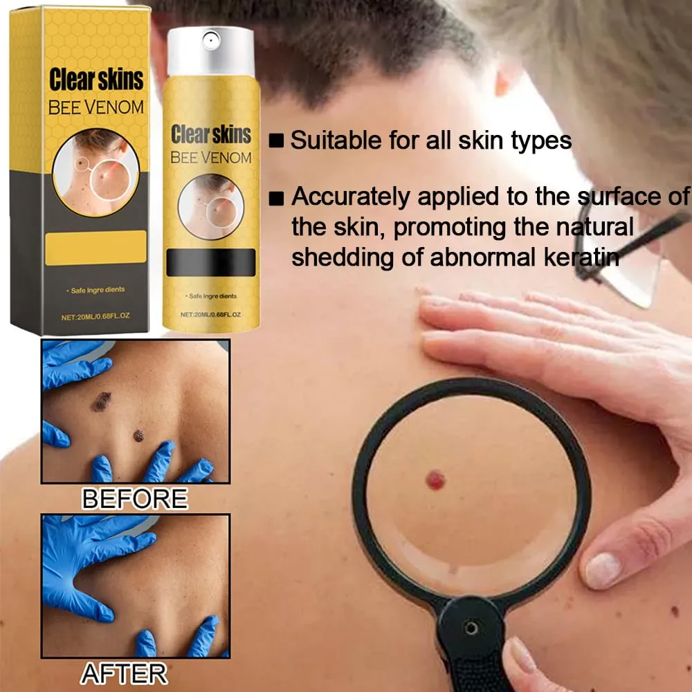 Bee Venom Skin Spray, 3 Packs Bee Venom Soothing Spray for All Skin Types 60ml