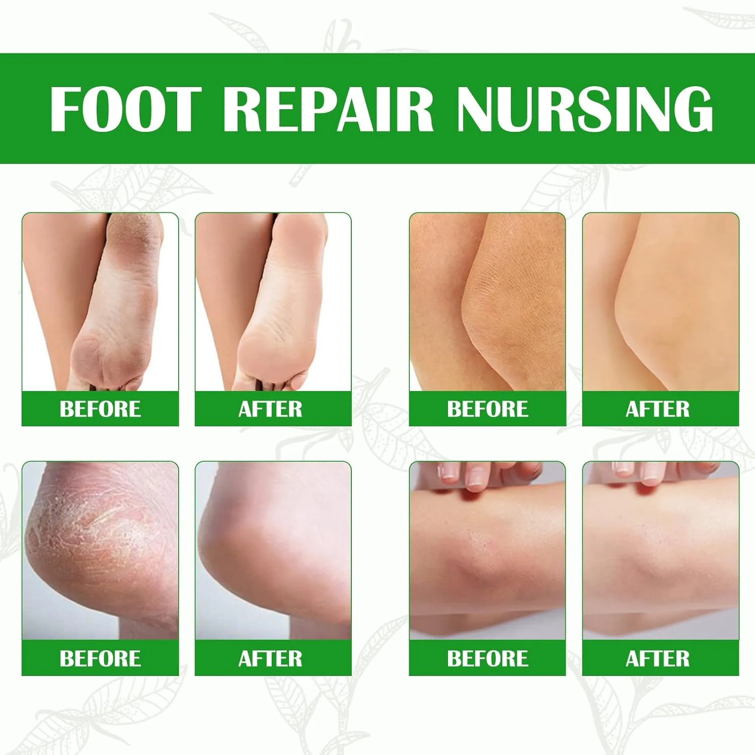Callus Remover for Feet, Instant Foot Peeling Spray, Feet Scrubber Dead Skin Remover Cracked Heels Softener, Works Great with Any Foot File or Scrubber, Hydrating Exfoliating Spray (2 PCS,Green Tea)