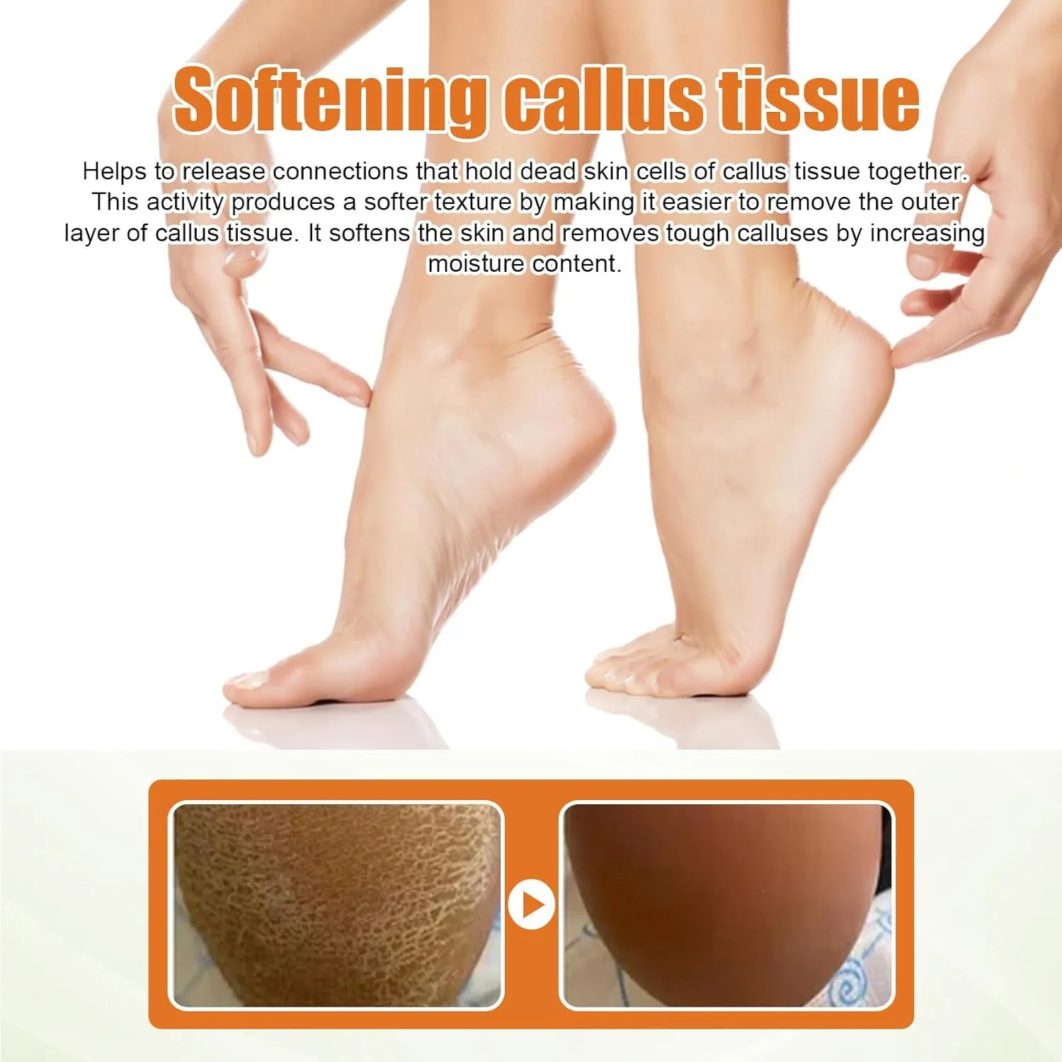 Foot Callus Removal Spray,Foot Peeling Spray Oil,Foot Heel Callus Remover Spray,Foot Peel Spray Remove Dead Skin,Suitable For Dry Rough Heels And Dry Toe Skin (3PCS)