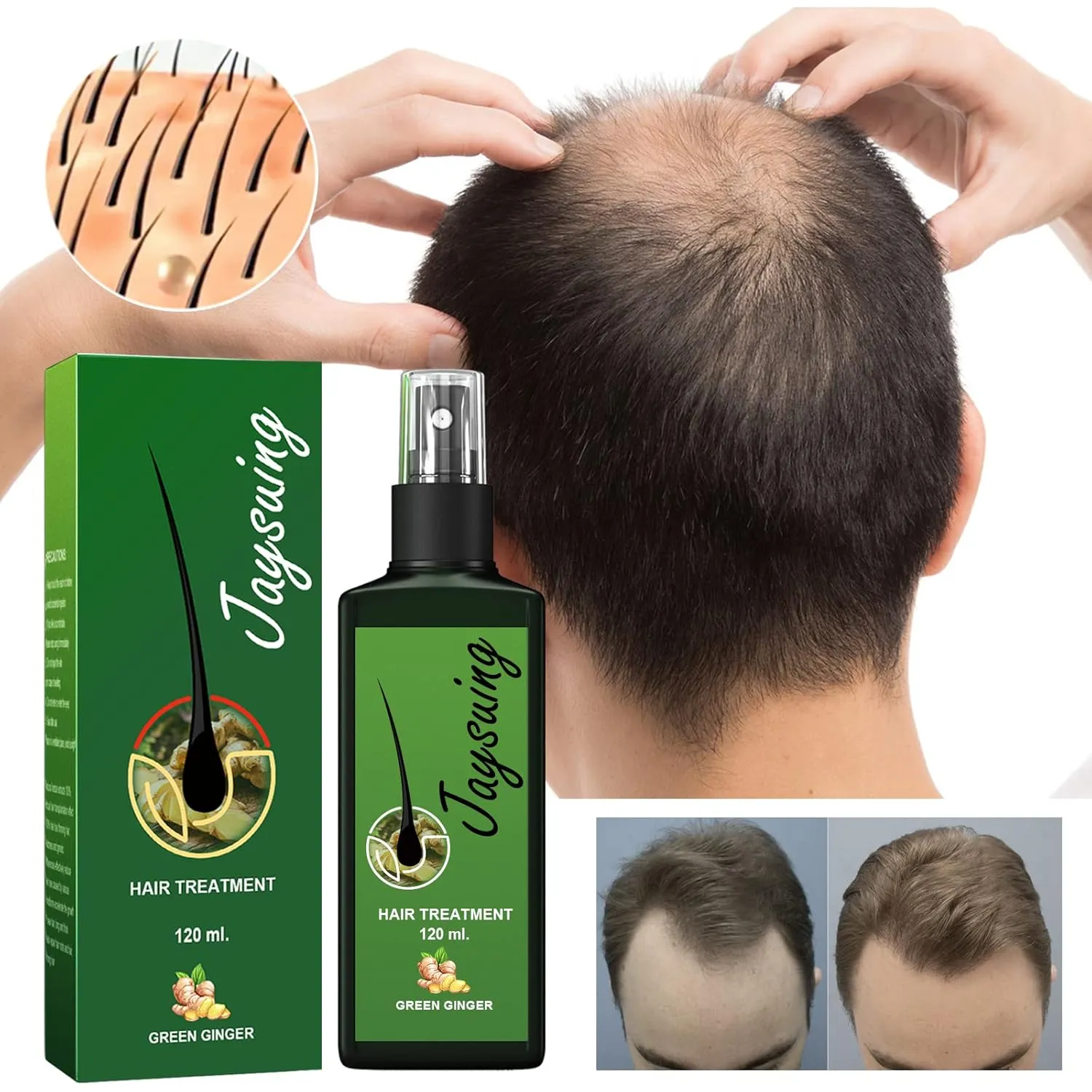 Hair Care Treatment Oil, Nourishing Scalp Massage Liquid,120ml*3